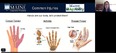 Poster showing drawings of hands that have Carpal Tunnel - Arthritis - or Trigger Finger and labeled COMMON INJURIES